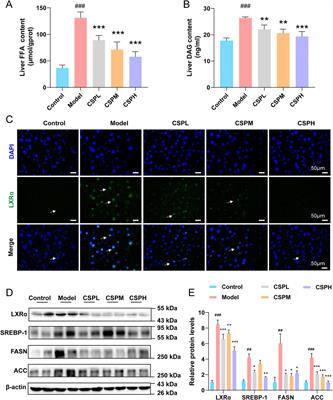 Chaihu Shugan powder restores fatty acid synthesis to alleviate insulin resistance in metabolic syndrome by regulating the LXRα/SREBP-1 signaling pathway